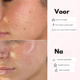Rozenserum met peptiden en PDRN